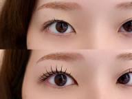 スワンラッシュbefore after